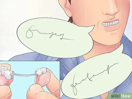 Image titled Handle Tooth Loss Step 4