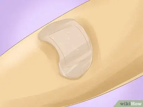 Image titled Prevent Staph Infection Step 4