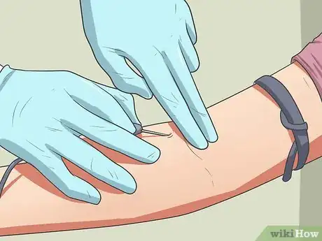 Image titled Start Using Accutane Step 9