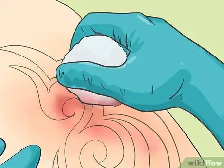 Image titled Tattoo Step 20