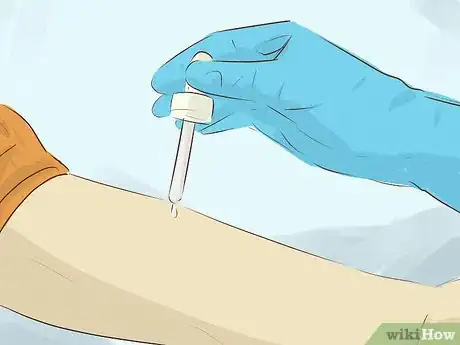 Image titled Live With an Allergy to Seafood Step 13