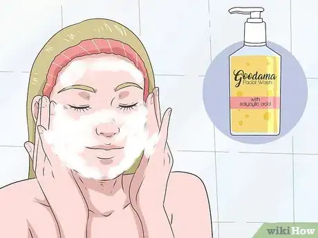 Image titled Avoid Fungal Acne Step 3