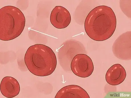 Image titled Treat Macrocytic Anemia Step 1