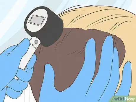 Image titled Know if You Have Male Pattern Baldness Step 9