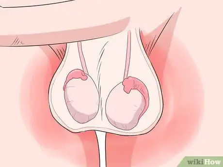Image titled Recognize Chlamydia Symptoms (for Men) Step 4