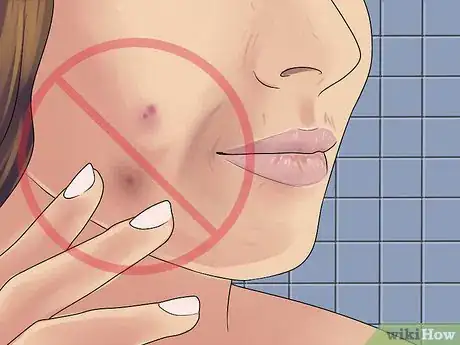 Image titled Reduce Menopausal Acne Step 18