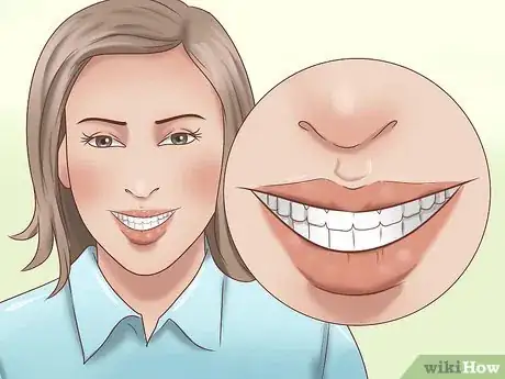 Image titled Have the Perfect Smile Step 5