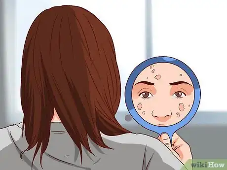 Image titled Get Rid of Age Spots Step 10