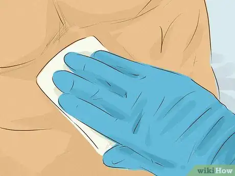 Image titled Help Someone Recover From a Liver Transplant Step 2