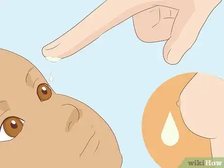 Image titled Clear a Blocked Tear Duct Step 7