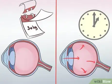 Image titled Diagnose Glaucoma in Poodles Step 11