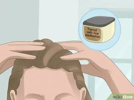 Image titled Prevent Lice in Dreadlocks Step 8