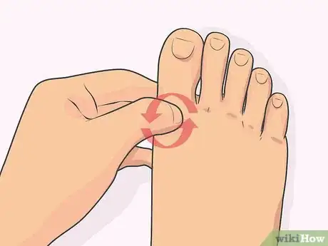 Image titled Read a Foot Reflexology Chart Step 7