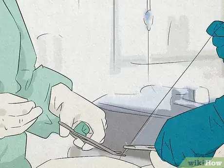 Image titled Get Rid of a Bartholin Cyst Step 5