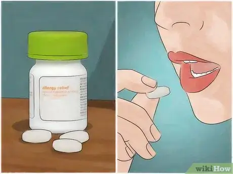 Image titled Identify Fire Ant Stings Step 6