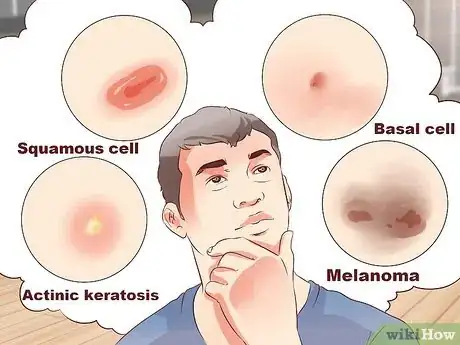 Image titled Prevent Skin Cancer for Kids Step 21