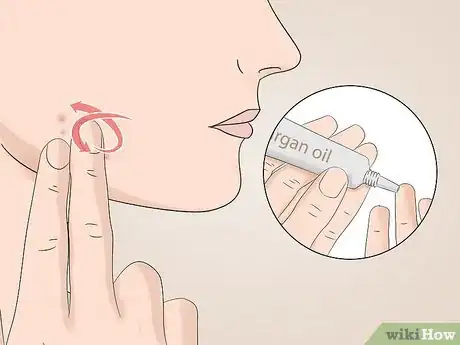 Image titled Use Argan Oil for Acne Step 6