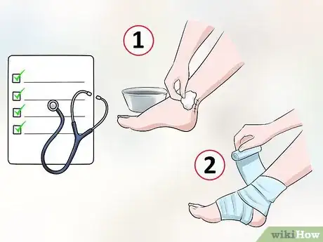 Image titled Treat a Growth Plate Fracture Step 9