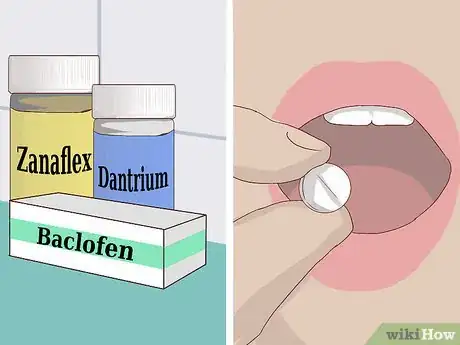 Image titled Deal with Spasticity Step 2