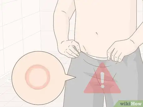 Image titled Prevent Molluscum (Molluscum Contagiosum) Step 9