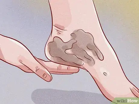 Image titled Fake a Tan Step 9