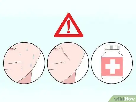 Image titled Clean Clogged Pores Step 6