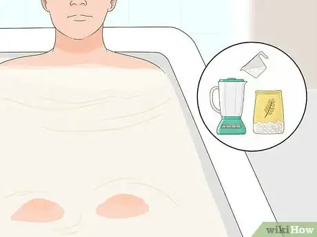 Image titled Soothe Bug Bites Step 16