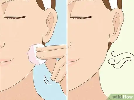 Image titled Clean Your Face to Prevent Pimples Step 6