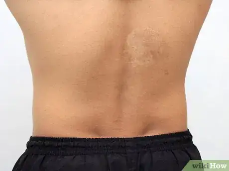 Image titled Relieve Lower Back Pain Through Stretching Step 3