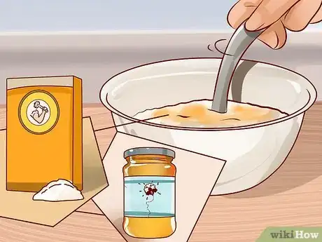 Image titled Get Rid of a Hard Pimple Step 5