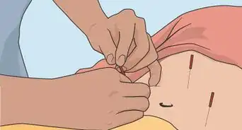 Treat Crohn’s Disease Naturally with Home Remedies