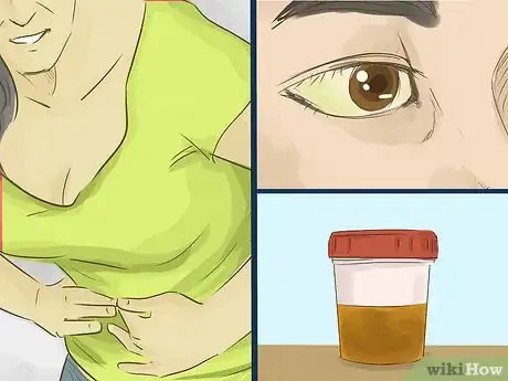 Image titled Help Someone Recover From a Liver Transplant Step 8