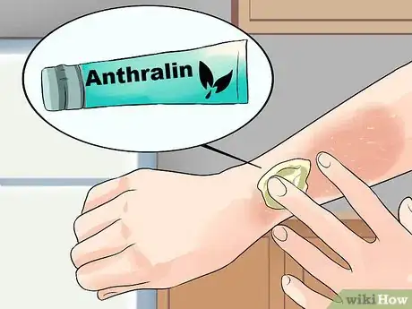 Image titled Avoid Psoriasis Vaccine Complications Step 12