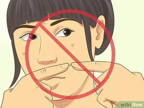 Image titled Not Let Acne Get You Down Step 4