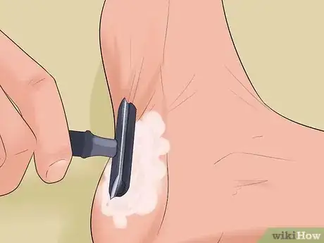 Image titled Identify and Treat Injuries From Stingrays and Sea Urchins Step 18