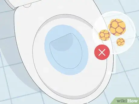 Image titled Prevent BV (Bacterial Vaginosis) Step 12