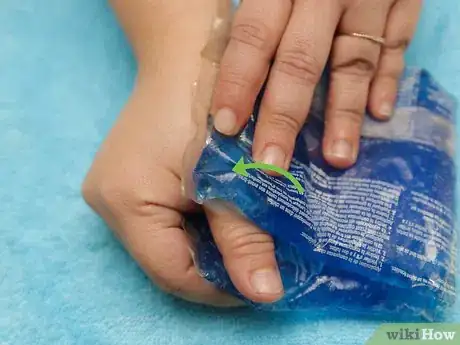 Image titled Strap a Thumb Step 14