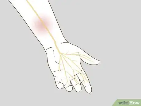 Image titled Apply Splints Step 9