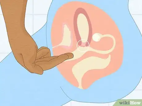 Image titled Work out Ovulation With Irregular Periods Step 3