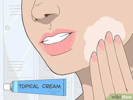 Image titled Get Beautiful African American Skin Step 14