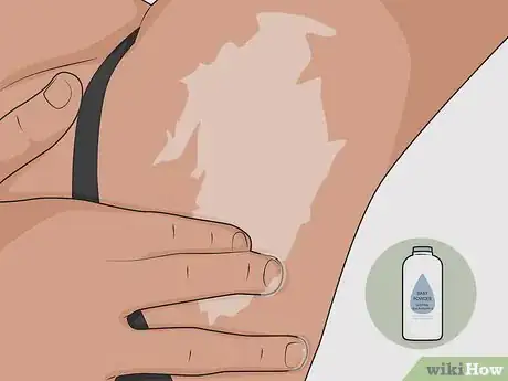 Image titled Heal Armpit Rash Step 12