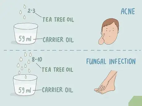 Image titled Heal Skin Naturally Step 11