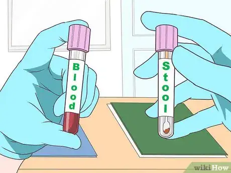 Image titled Stop Rectal Bleeding Step 6
