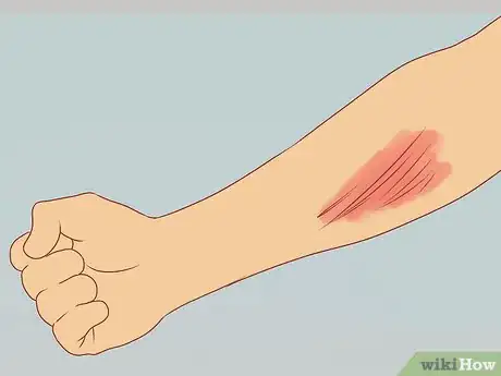 Image titled Prevent Common Krav Maga Injuries Step 19