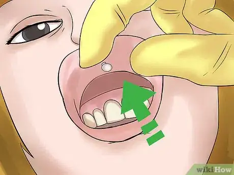 Image titled Take Out a Monroe Piercing Step 5