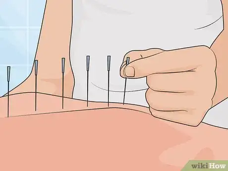 Image titled Treat Bipolar Disorder Naturally Step 19