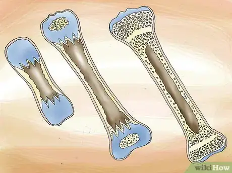 Image titled Supplement Vitamin D in Babies Step 6.jpeg