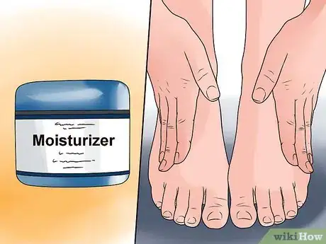 Image titled Treat Winter Eczema Step 1