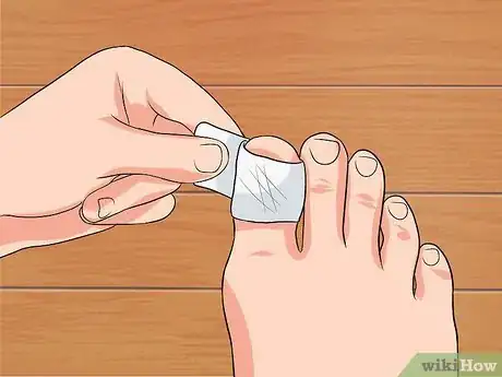 Image titled Remove a Dead Toenail Step 10