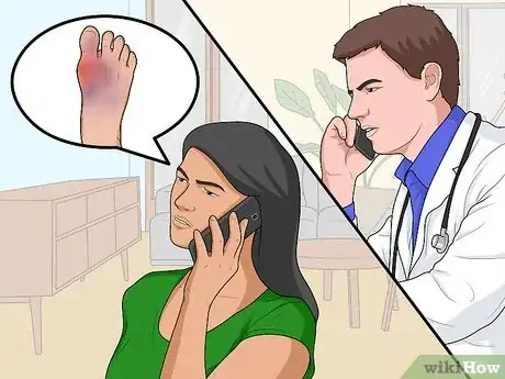 Image titled Treat Bunions Naturally Step 13